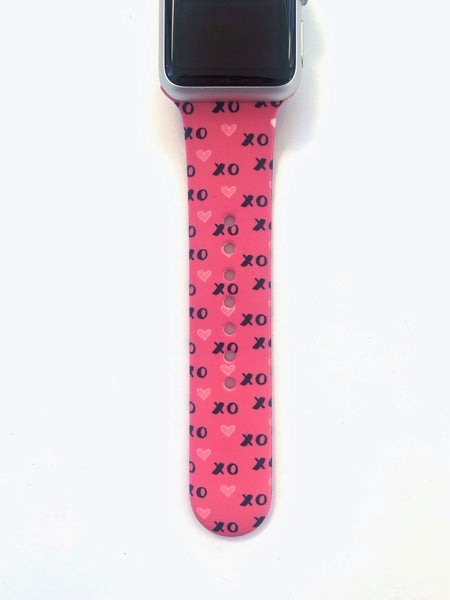 Valentine's and St Patrick's Apple Watch Bands